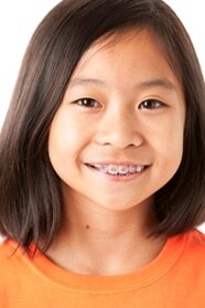 Braces Orthodontist Corpus Christi