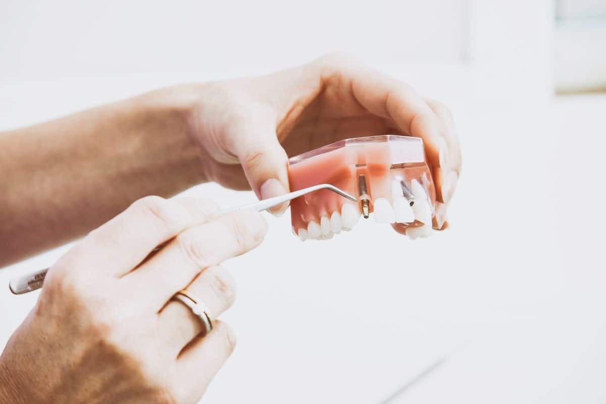Dentist examining dental implant model with examination tool during patient consultation.