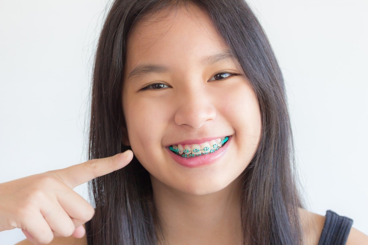 How to Brush Your Teeth with Braces