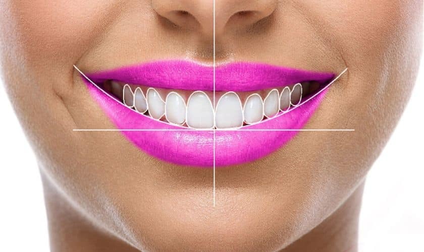 Close-up of a bright white smile with perfect teeth and vibrant pink lips showing cosmetic smile design results.