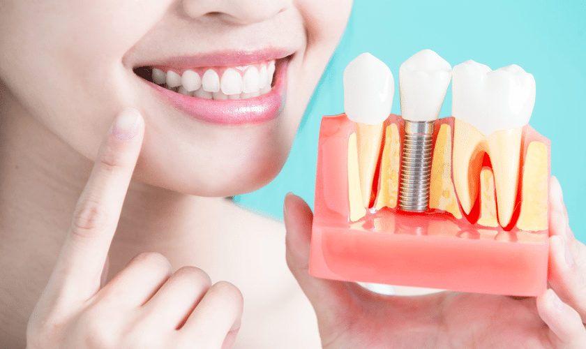 Woman smiling while holding a dental implant model showing tooth structure and placement in Corpus Christi.