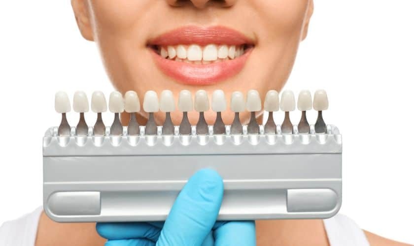 Dental professional holding tooth shade guide displaying cosmetic veneer color options for smile enhancement.