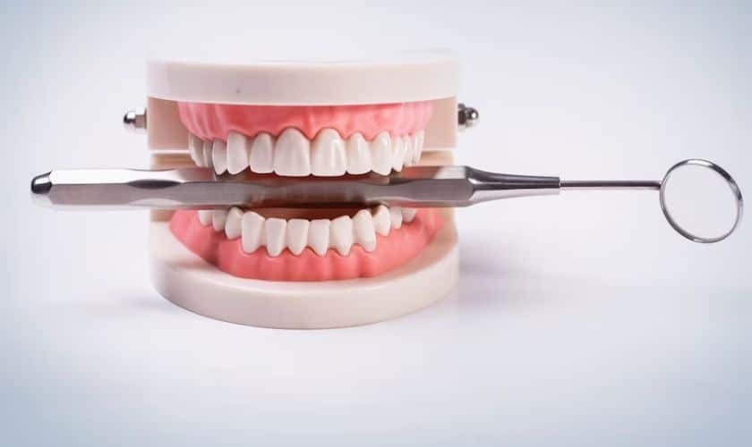 Dental model showing upper and lower teeth with mirror and explorer tool for implant assessment.