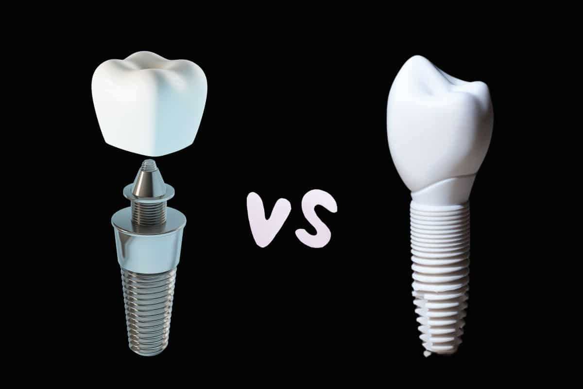 Titanium dental implant compared to ceramic implant showing component structures and design differences.