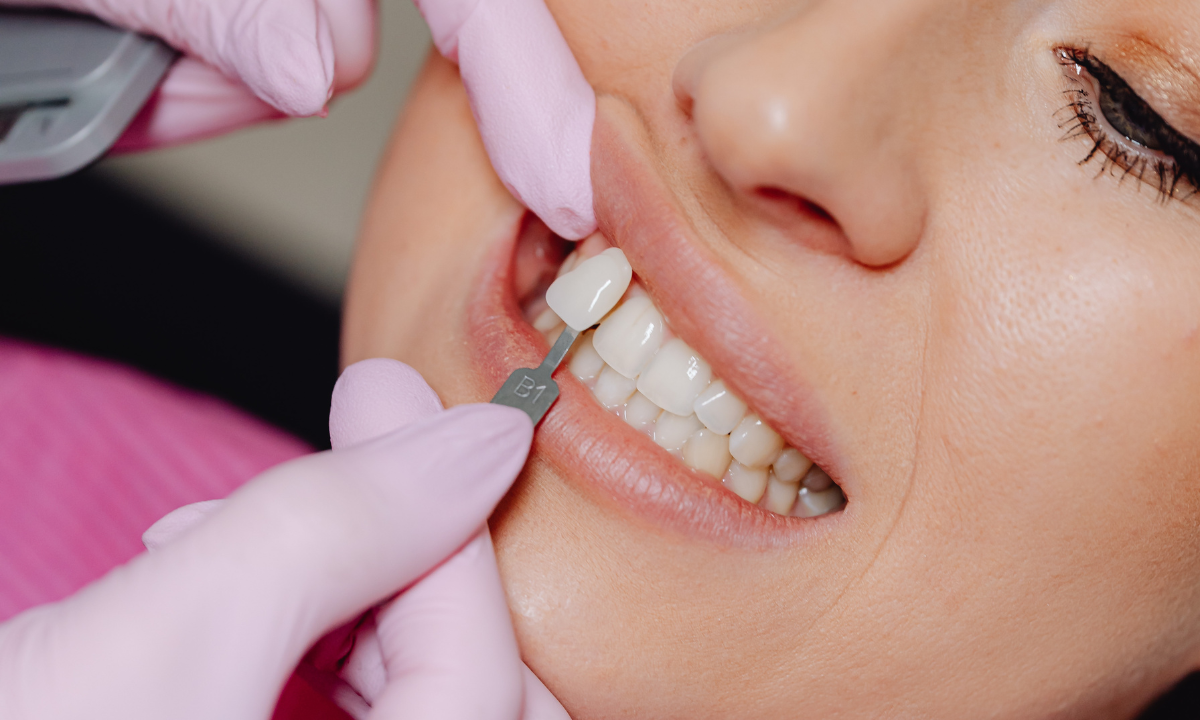 What to Do If Your Dental Implant Feels Loose