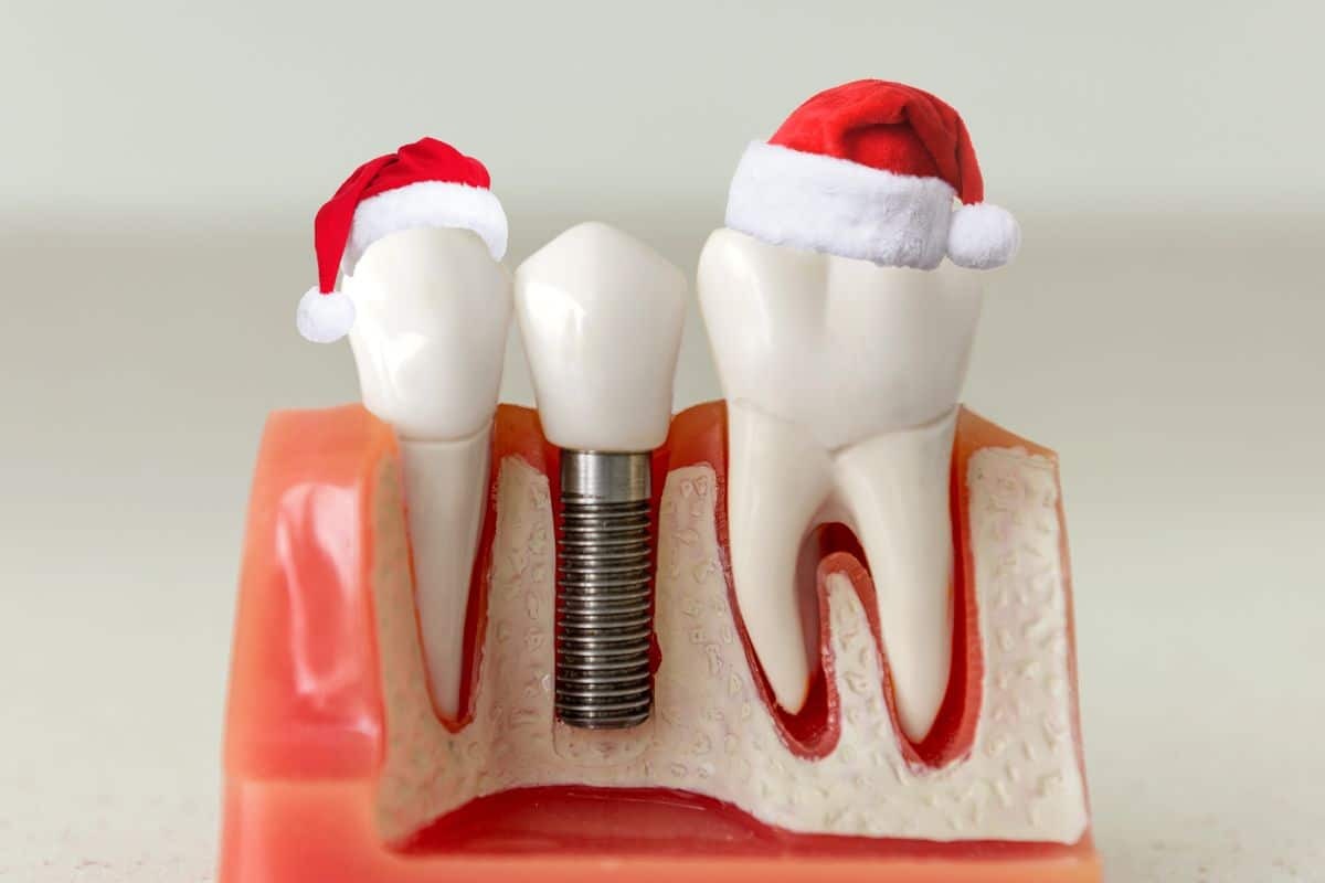 Dental implant model showing tooth replacement with metal implant post and natural teeth wearing Santa hats.