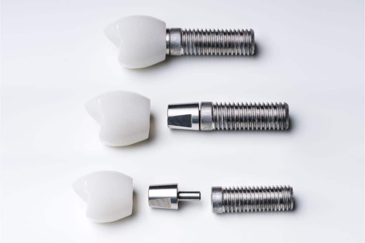 Dental implant components showing abutment, post, and crown assembly for tooth replacement.