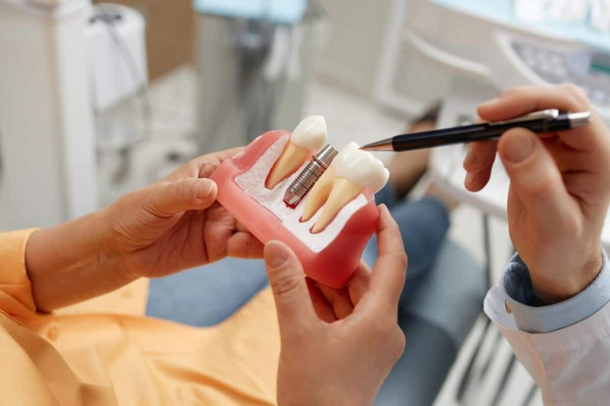 Dentist pointing to dental implant model showing tooth replacement options for missing teeth.