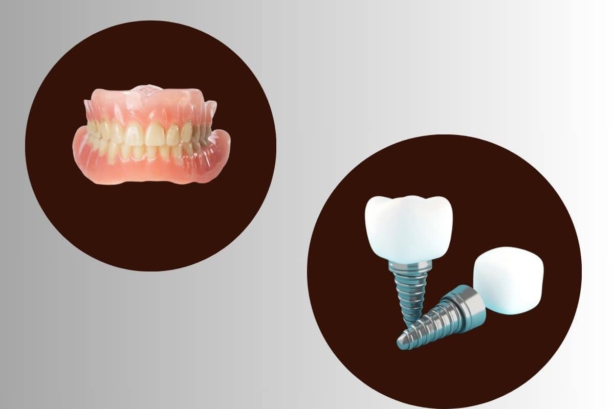 Comparison of full mouth dentures and dental implants with crowns for tooth replacement options.