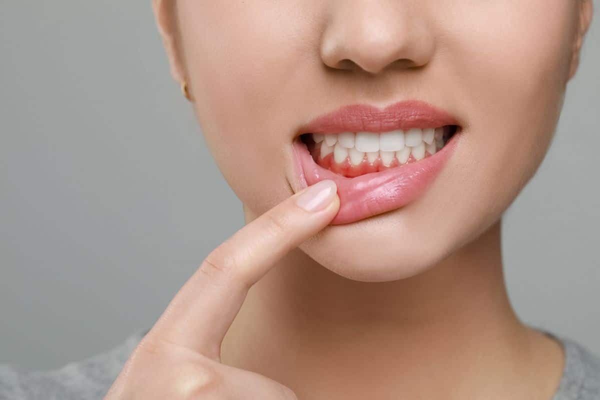 Woman pointing to her lower lip, displaying healthy white teeth and pink gums.