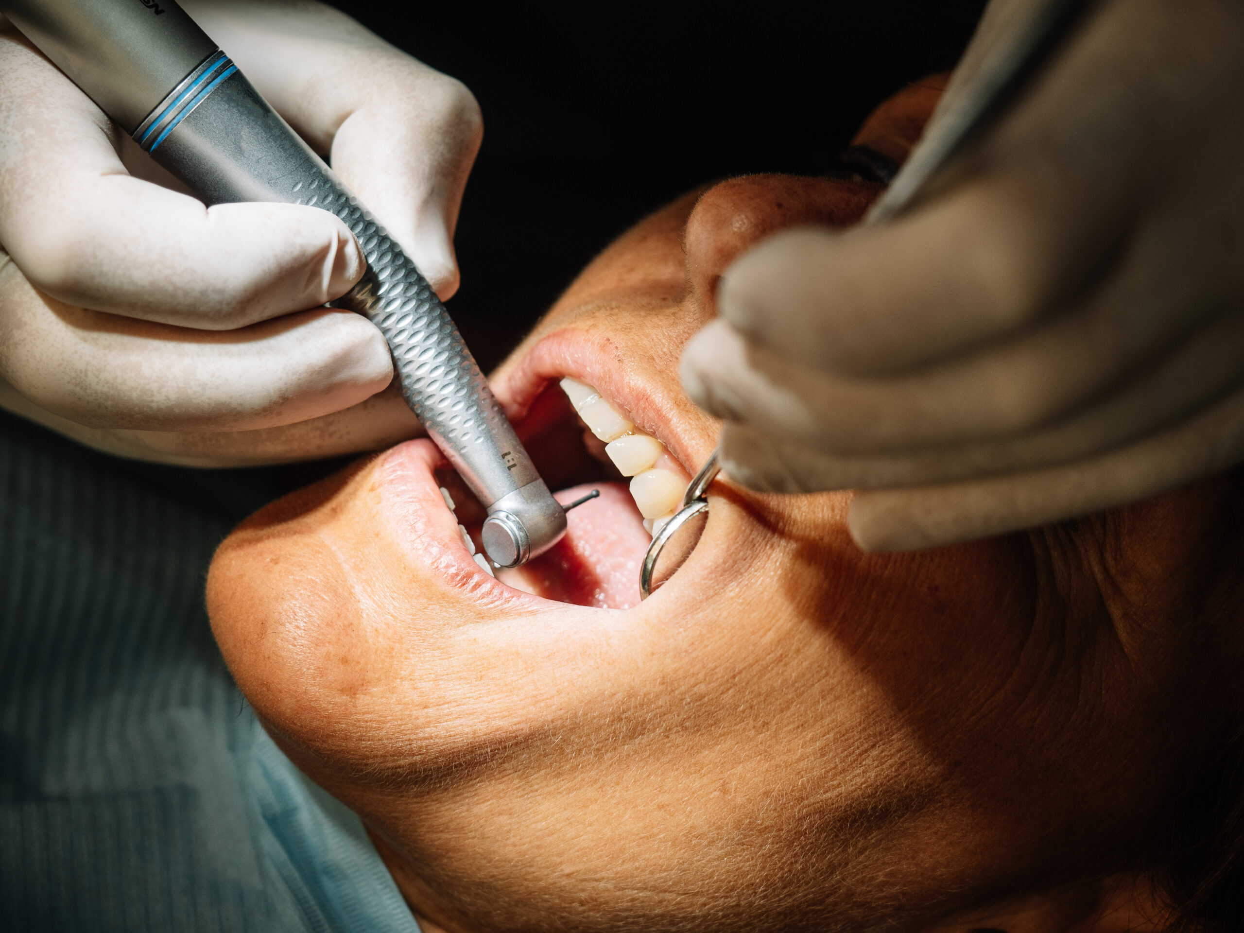 Dentist using dental handpiece to examine and clean patient's teeth during professional cleaning.