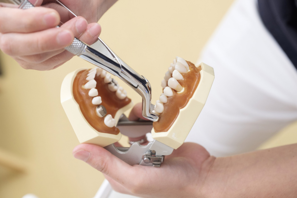 Dentist examining dental model showing teeth extraction site with extraction forceps during consultation.