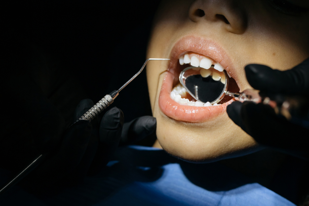 Featured image for “How Long Does the Complete Dental Implant Process Take From Consultation to Final Restoration?”